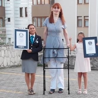 La donna più alta del mondo vive in Turchia: "Accettatevi per quello